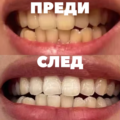 PAP+ Powder - Whitening Booster